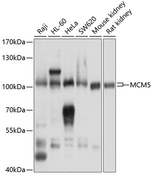 MCM5 antibody