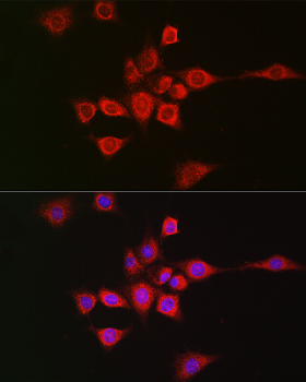 METTL4 antibody