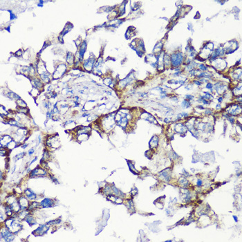 MMP16 antibody