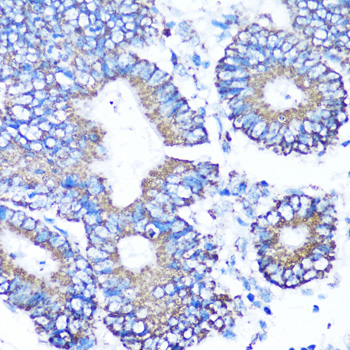 MMP16 antibody