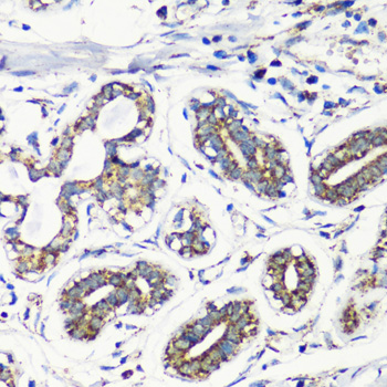 MMP16 antibody