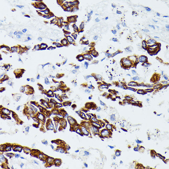 MMP25 antibody