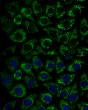 MTIF2 antibody