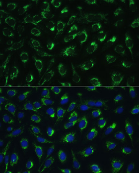 MTIF2 antibody