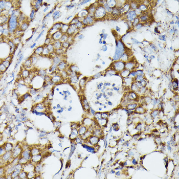 MTIF2 antibody