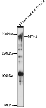 MYH2 antibody