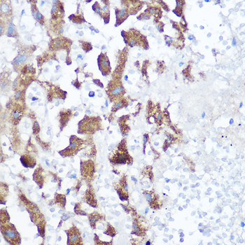 NDUFB4 antibody