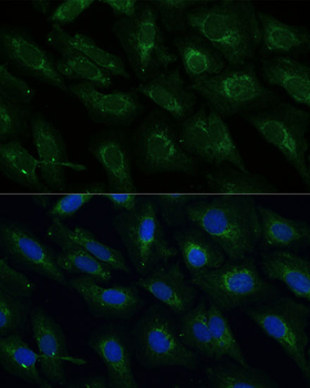 NDUFB4 antibody