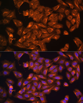 NF2 antibody