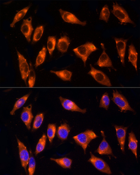 NPHP4 antibody