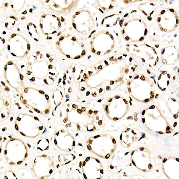 NR2F2 antibody