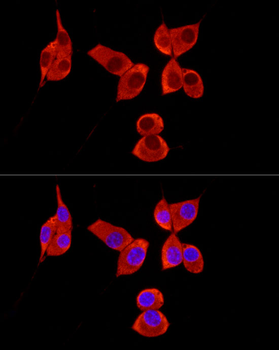 PABPC1 antibody