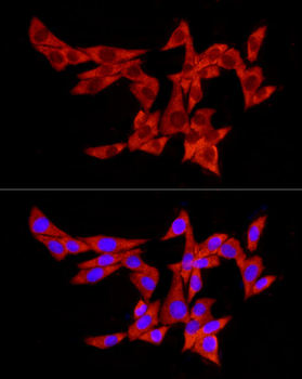 PABPC1 antibody