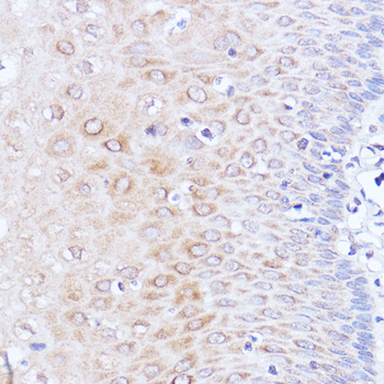 PABPC1 antibody