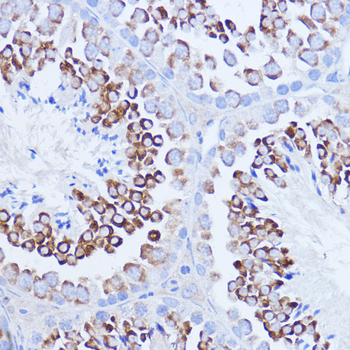 PABPC1 antibody