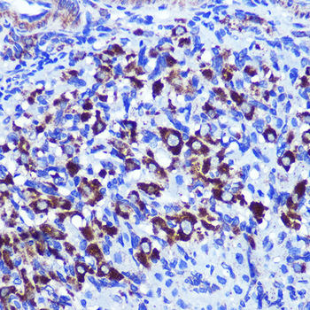 PALLD antibody