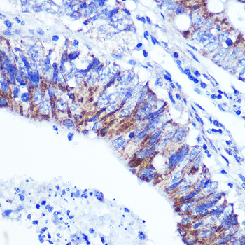 PALLD antibody