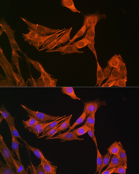 PALLD antibody