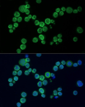 PARP1 antibody