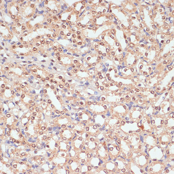 PARP1 antibody