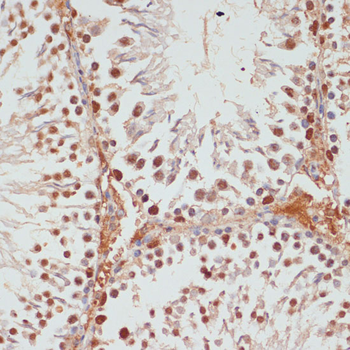 PARP1 antibody