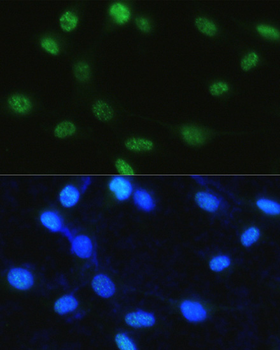 Histone H3 (Phospho-S28) antibody