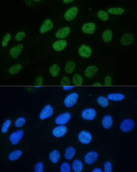 Histone H3 (Phospho-S28) antibody