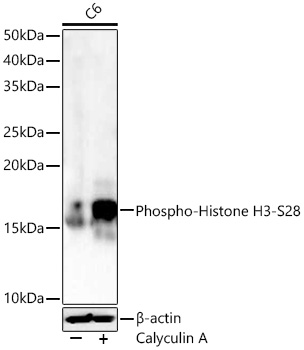 Histone H3 (Phospho-S28) antibody