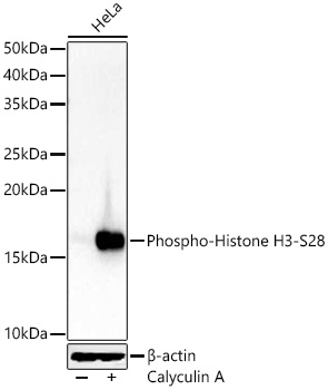 Histone H3 (Phospho-S28) antibody