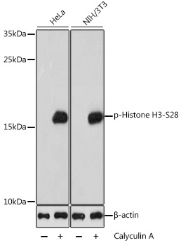 Histone H3 (Phospho-S28) antibody