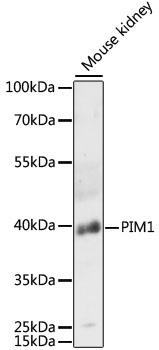 PIM1 antibody