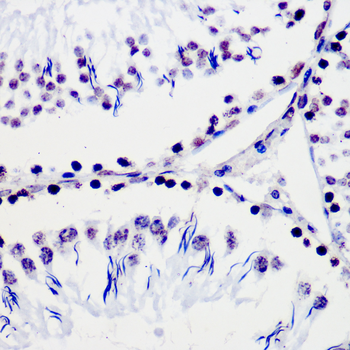 PIM1 antibody