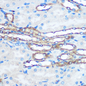 PKM antibody