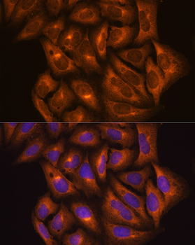 PKM antibody