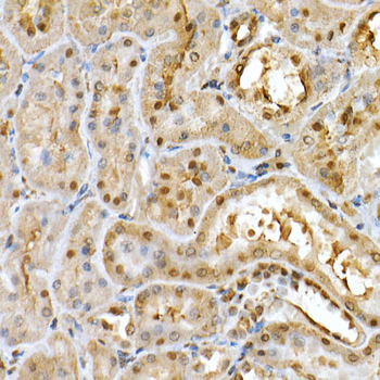 PPARGC1A antibody