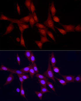 PPARGC1A antibody