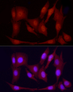 PPARGC1A antibody