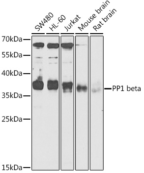 PPP1CB antibody