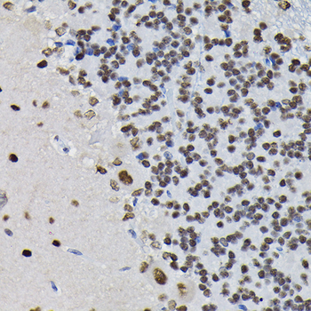 PPP1CB antibody