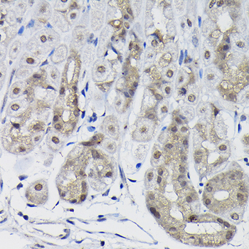 PPP1CB antibody