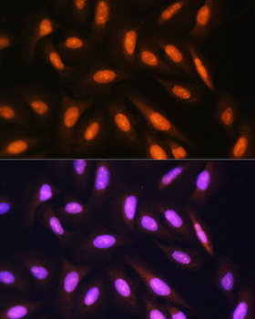 PPP1CB antibody