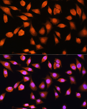 PPP1CB antibody