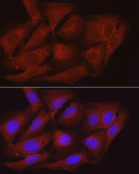 PPP1R12A antibody