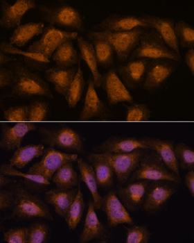 PPP2R5D antibody