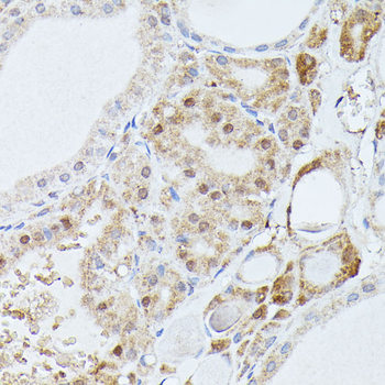 PPP2R5D antibody