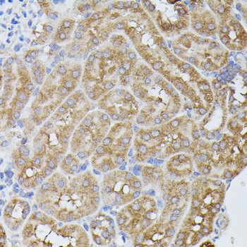 PPP2R5D antibody