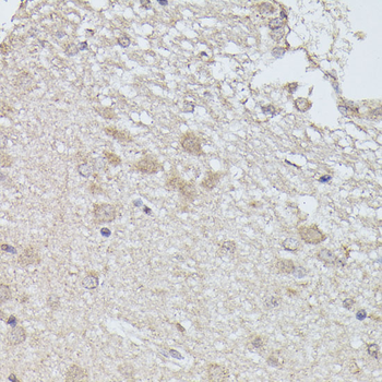 PPP2R5D antibody