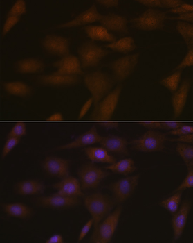 PYCARD antibody