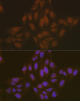 PYCARD antibody