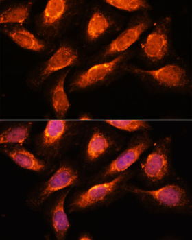 RAB1A antibody